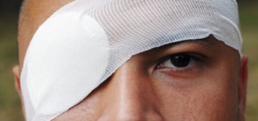 Медичні поради: як діяти у разі травмування ока?